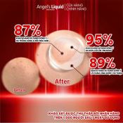 Kem Face Angel's Liquid Glutathione Niacinamide 7Day Whitening Program 700V Dưỡng Trắng Se Khít Lỗ Chân Lông  50ml-3