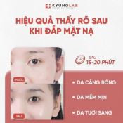 Mặt Nạ Kyunglab Pdrn Therapy Mask Phục Hồi & Tái Tạo Da 10 Miếng-1