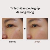 Tinh chất Medi Peel BorTox Peptide Ngăn Ngừa Lão Hóa 30ml 30ml-3