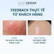 Serum Sena Demar B5 Microneedle Ampoule Phục Hồi, Tái Tạo Da Hiệu Quả 100Ml-3