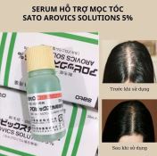 Thuốc Mọc Tóc Sato Arovics Solutions 5% Nhật Bản Lọ 30Ml-2